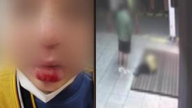 [단독] 유명 전직 카레이서, 8살 아이 발로 차고 '내동댕이'...경찰 수사