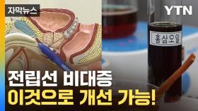 [자막뉴스] 이렇게 효과가 좋다고?...홍삼 오일의 놀라운 발견