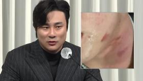 김하성 후배 임혜동, 폭행 사진까지 공개 