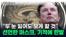 시각장애인에 대혁명...머스크 '야심작' 또 해내나 [지금이뉴스]