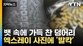 [자막뉴스] 공항에서 붙잡힌 여성, 엑스레이 찍어보니... '충격적인 광경'