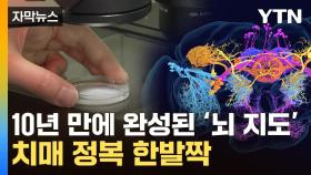 [자막뉴스] '인간 뇌' 비밀 풀리나...초파리에서 찾아낸 해답