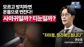 [메디컬 인사이트 53회] 피부과 전문의가 알려주는 '티눈과 사마귀'의 증상과 치료법