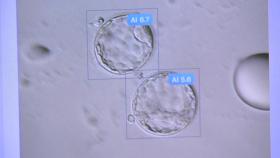 사람 눈 대신 AI로 건강한 배아 더 정확히 골라낸다