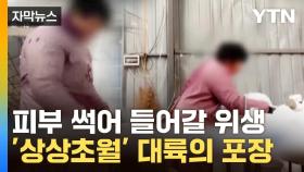 [자막뉴스] 