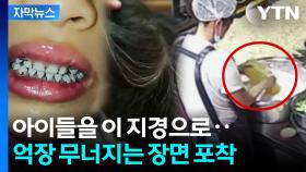 [자막뉴스] 치아 새까맣게 변하고 탈모에 새치...CCTV에 포착된 장면