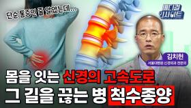 [메디컬 인사이트 93회] 신경외과 전문의가 알려주는 '척수종양의 증상과 치료법'