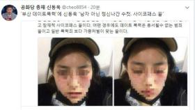 신동욱 ＂부산 데이트 폭력, 정신나간 수컷·잠재적 사이코패스＂