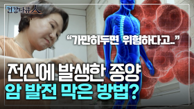 [건강다큐人] 전신에 발생한 종양 암 발전 막은 방법?