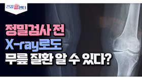 [건강 콜센터] 정밀검사 전 X-ray로도 무릎 질환 알 수 있다?