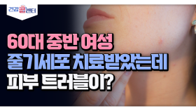 [건강 콜센터] 60대 중반 여성, 줄기세포 치료받았는데 피부 트러블이?