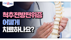 [건강 콜센터] 척추전방전위증 어떻게 치료하나요?