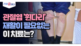 [건강 콜센터] 관절염 ′휜다리′ 재활이 필요없는 이 치료는?