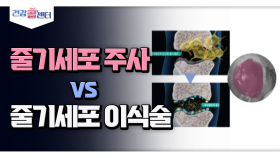 [건강 콜센터] 줄기세포 주사 vs 줄기세포 이식술