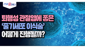 [건강 콜센터] 퇴행성 관절염에 좋은 ′줄기세포 이식술′ 어떻게 진행될까?