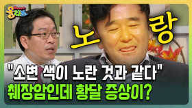 [건강버라이어티 올리브] ＂소변 색이 노란 것과 같다＂ 췌장암인데 황달 증상이?