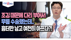 [건강 콜센터] 조깅 때문에 다리 부어서 무릎 수술했는데.. 흉터만 남고 여전히 아프다?!
