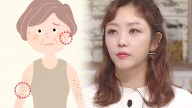 자외선에 의해 생겨나는 검버섯과 피부암의 차이 (황금장바구니)