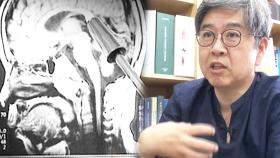 시한폭탄, 허술한 제도 속 도로 위 중증 뇌질환 운전자