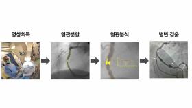 희귀 질환을 진단하는 방법이 있다?