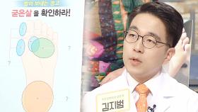 발을 보면 질병이 보인다! 굳은살이 보내는 ‘SOS 신호’ (건강 대해부)