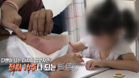 아파트 단지 내 사고로 사라지지 않는 ‘트라우마’