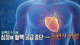 ‘돌연사 위험’ 초겨울에 더 위험한 심혈관질환! (닥터필생기)
