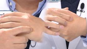 손 잘 붓는 사람들을 위한 ‘손 지압법’ (닥터필생기)