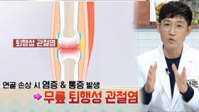 삶의 질을 떨어트리는 질환! ‘퇴행성 관절염’ (좋은아침N보건소)