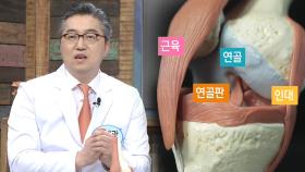 통증 일으키는 관절 질환 ‘퇴행성 관절염!’ (똑똑똑!고민상담소)