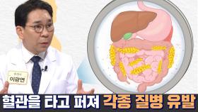 내장 지방으로 인해 생길 수 있는 건강 문제!(황금 복주머니)