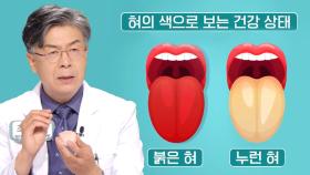 전신 건강 신호등, ‘혀’로 보는 건강 상태! (닥터필생기)