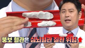 심뇌혈관 질환 위험성을 급격히 높이는 ‘뚱보 혈관’의 위험성! (황금복주머니)