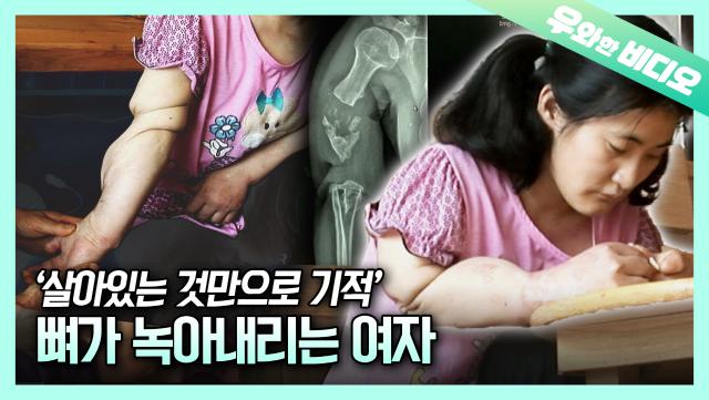 통증을 느끼지 못하는 기적의 여인┃The Miraculous Woman Who Can't Feel Pain