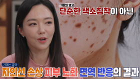 만성 염증까지 유발하는 ‘기미’의 악영향※