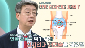 연골 손상 가속화 만드는 스포츠 손상, ‘십자인대 파열’ (더건강한스쿨)