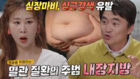 건강에 위협적인 독성 덩어리 ‘내장지방’