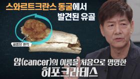 그림자처럼 따라다니며 인류 괴롭힌 ‘암’