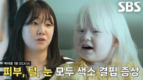 선천적 유전으로 남들과 다르게 태어난 ‘빛의 아이’