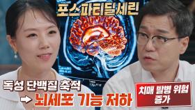 치매 위험 증가! 노화에 급격히 감소하는 ‘포스파티딜세린’