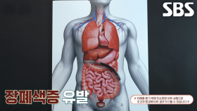방치한 변비, 심각한 장폐색증 유발! (닥터필생기)
