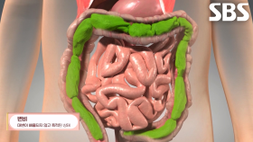 장 건강 위험 신호, 변비♨ (닥터필생기)