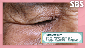 자외선 차단 소홀해지는 가을에 ‘피부장벽’ 세워야 하는 이유