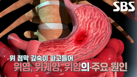 위암·대장암 유발에 영향 주는 ‘헬리코박터 파일로리균’ (똑똑똑!고민상담소)