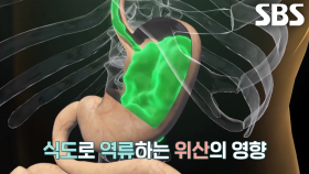 ‘위산 과다’의 대표적인 증상 (똑똑똑!고민상담소)
