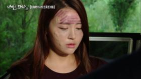 환자의 얼굴을 망쳐놓은 의사, 무슨 짓을?!