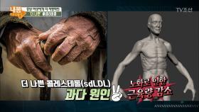 중년 ‘여성’에게 더 치명적인 ‘더 나쁜’ 콜레스테롤, 그 이유는?