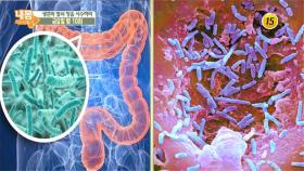 생존의 열쇠 장을 사수하라!_내 몸 사용설명서 178회 예고