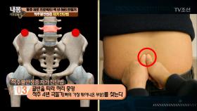 허리 통증 있다면? 척추불안정증 자가 진단법!