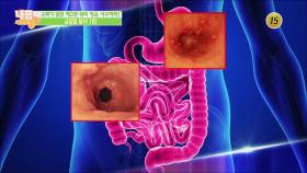 국민병 소화기 질환 제2편, 위와 장을 사수하라!_내 몸 사용설명서 239회 예고